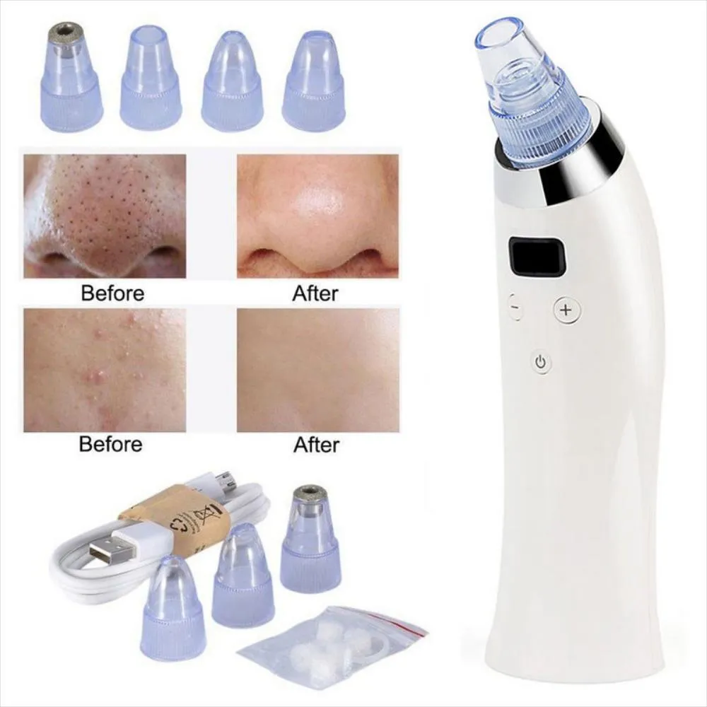 Extractor Digital Quita Espinillas Grasa